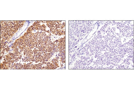 Immunohistochemistry Image 2: CDK4 (D9G3E) Rabbit Monoclonal Antibody