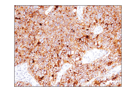 Immunohistochemistry Image 2: CD47 (D3O7P) Rabbit Monoclonal Antibody