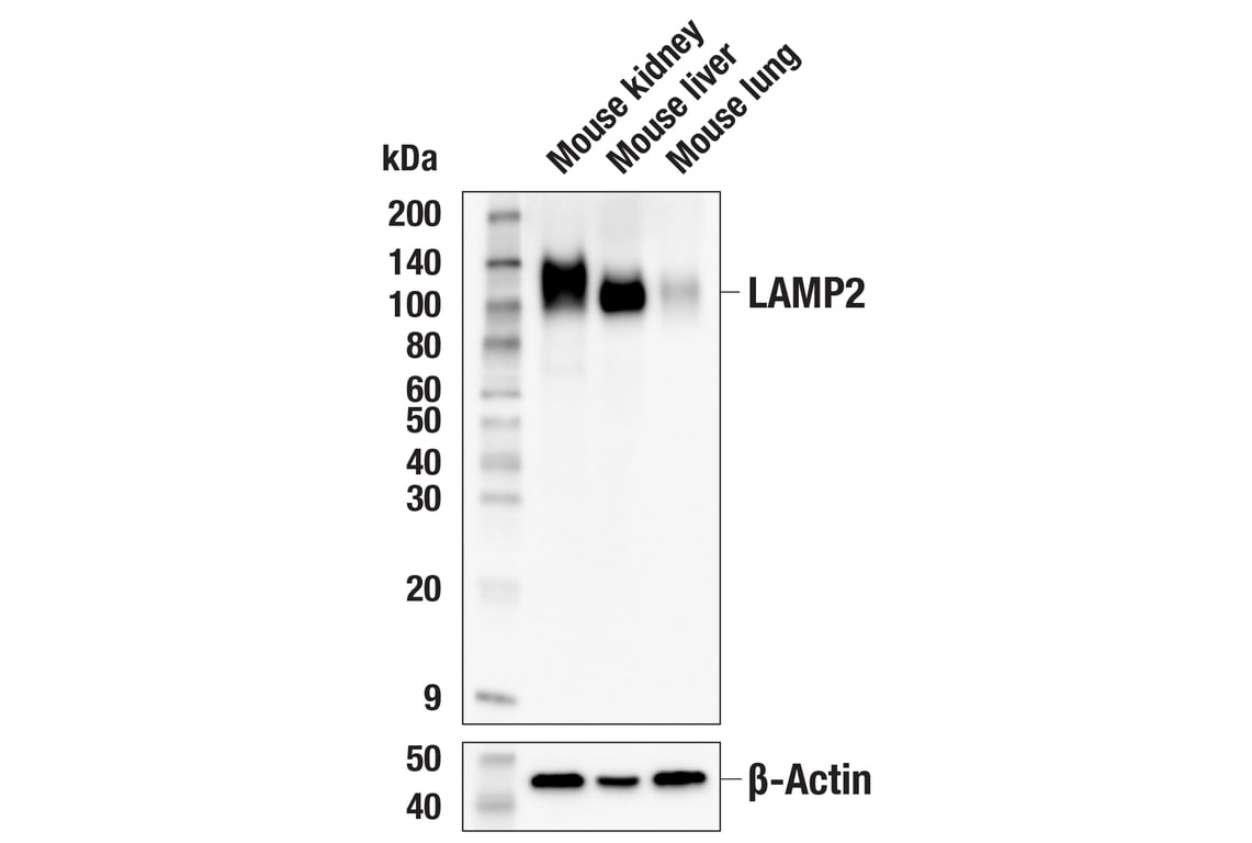 Western Blotting Image 2: LAMP2 (E6A6S) Rabbit Monoclonal Antibody