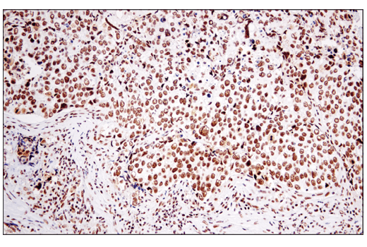 Immunohistochemistry Image 4: DNA-PKcs (E6U3A) Rabbit Monoclonal Antibody (BSA and Azide Free)