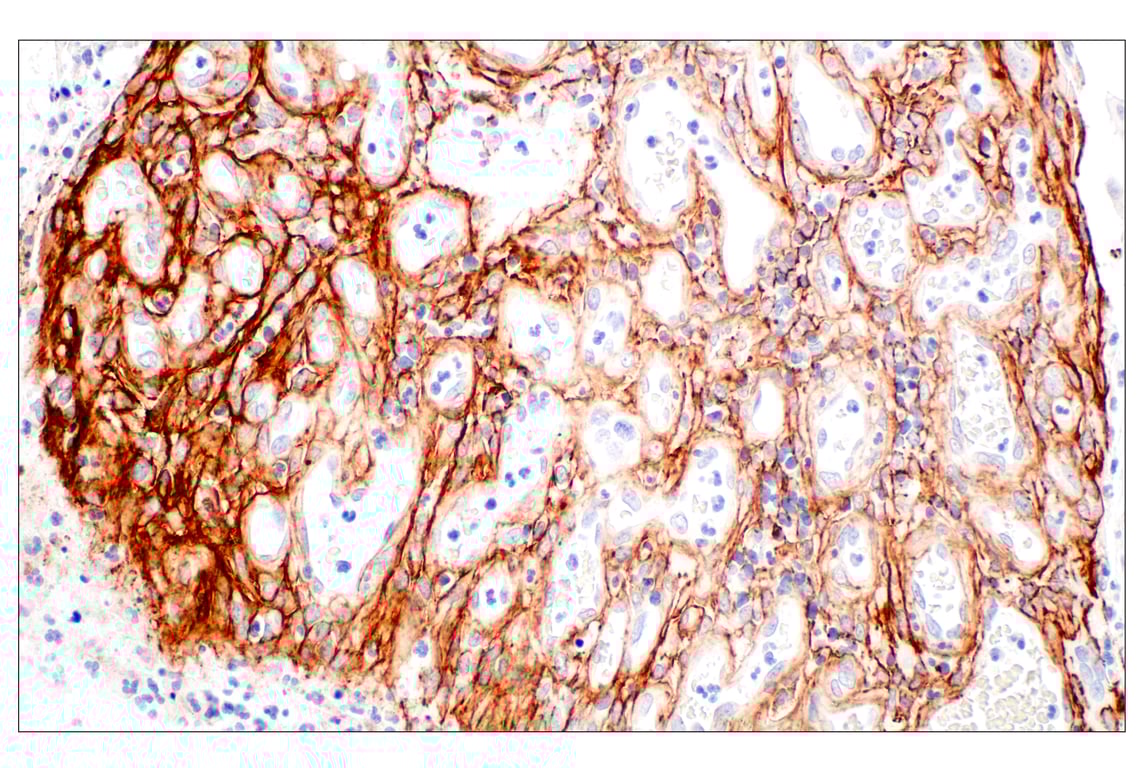 Immunohistochemistry Image 2: Tenascin C (E6N4L) Rabbit Monoclonal Antibody