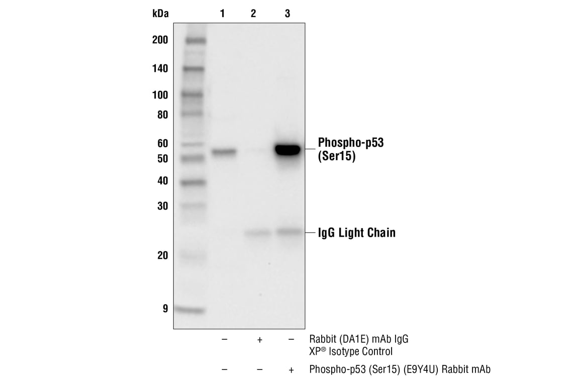 Immunoprecipitation Image 1: Phospho-p53 (Ser15) (E9Y4U) Rabbit Monoclonal Antibody