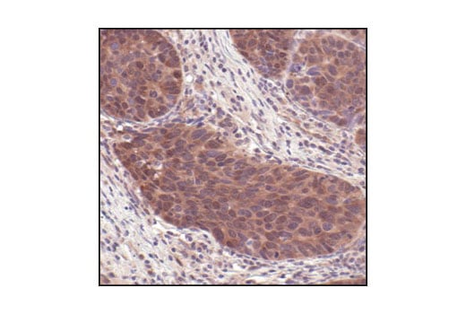 undefined Image 13: 4E-BP Antibody Sampler Kit