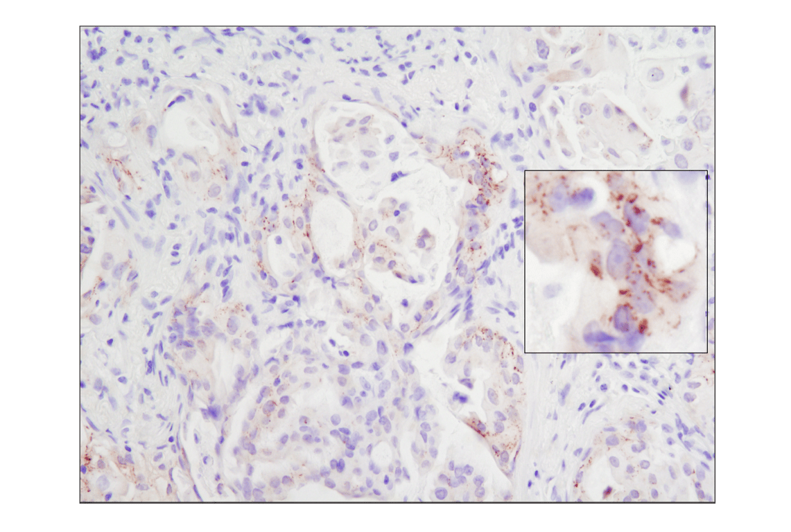 Immunohistochemistry Image 1: ROS1 (D4D6) Rabbit Monoclonal Antibody