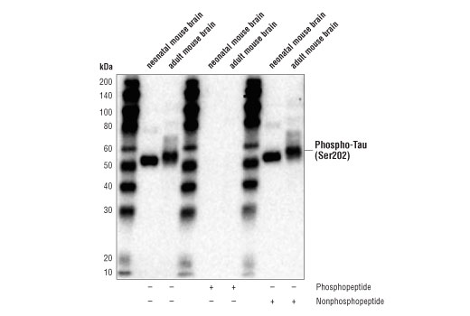 undefined Image 17: Phospho-Tau Family Antibody Sampler Kit