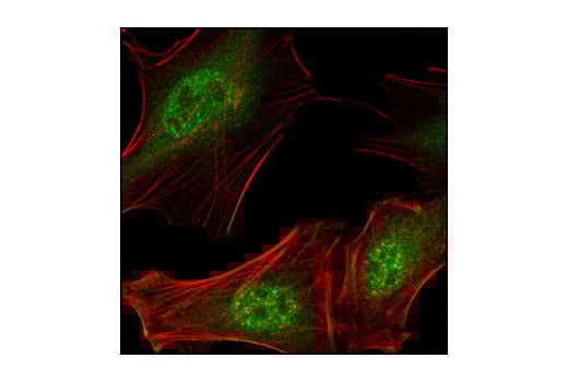 undefined Image 10: ATRX/Daxx Antibody Sampler Kit