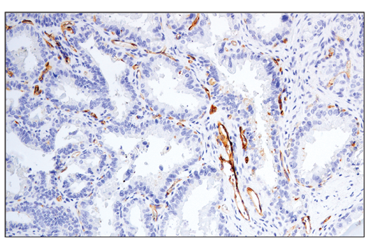 Immunohistochemistry Image 1: CD54/ICAM-1 (E3Q9N) Rabbit Monoclonal Antibody (BSA and Azide Free)