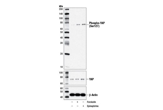 Western Blotting Image 3: Phospho-YAP (Ser127) (D9W2I) Rabbit Monoclonal Antibody (BSA and Azide Free)