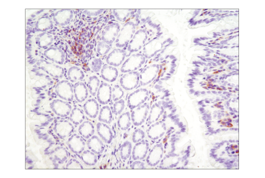 Immunohistochemistry Image 2: Btk (D3H5) Rabbit Monoclonal Antibody (BSA and Azide Free)