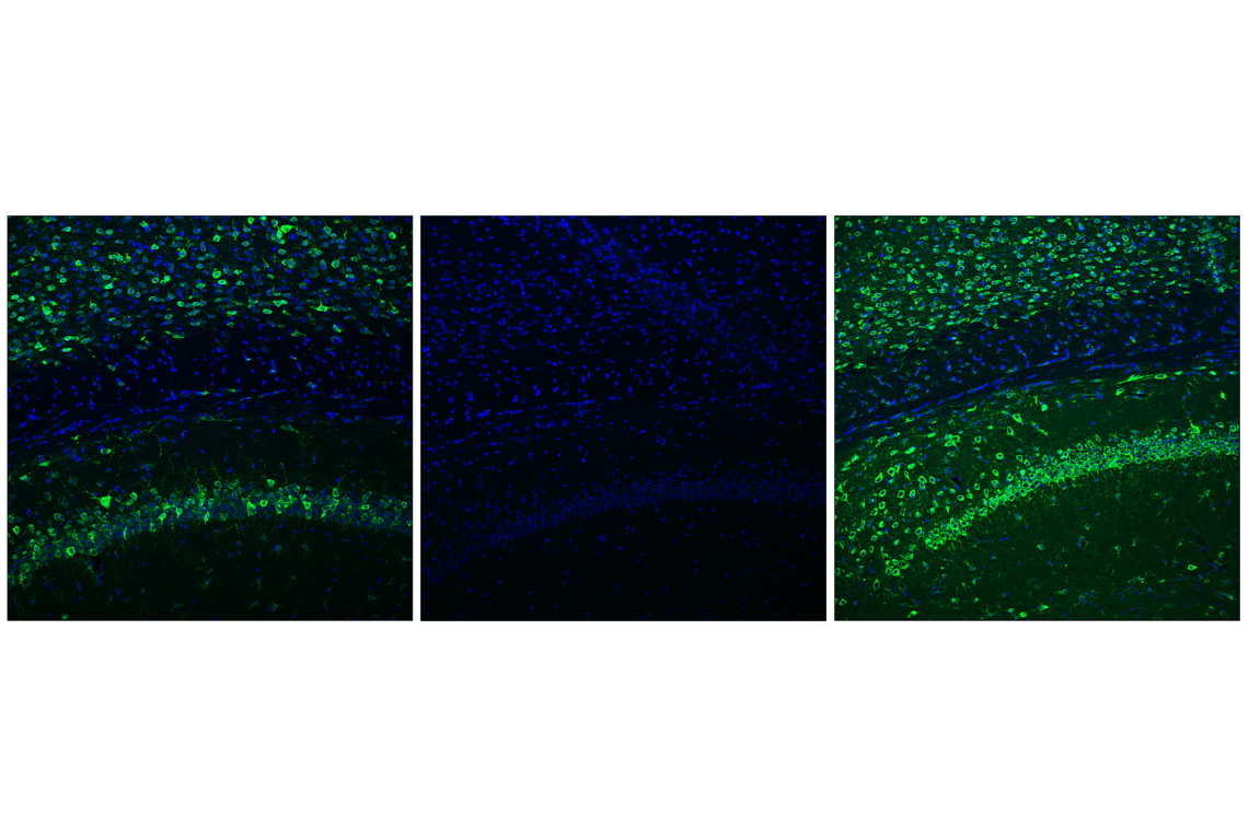 Immunofluorescence Image 1: Phospho-S6 Ribosomal Protein (Ser235/236) (D57.2.2E) Rabbit Monoclonal Antibody