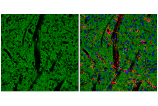 Immunofluorescence Image 4: SynGAP-alpha2 (E4Y6I) Rabbit Monoclonal Antibody
