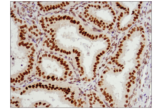 Immunohistochemistry Image 3: Exportin-1/CRM1 (D6V7N) Rabbit Monoclonal Antibody