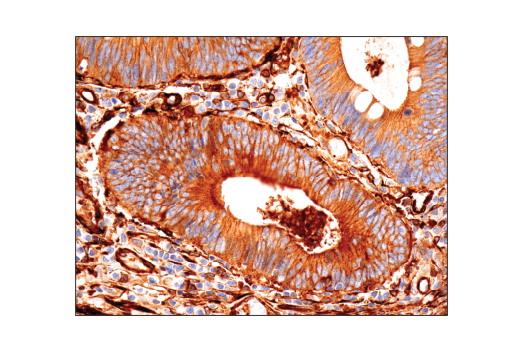 Immunohistochemistry Image 2: Vinculin (E1E9V) Rabbit Monoclonal Antibody (BSA and Azide Free)