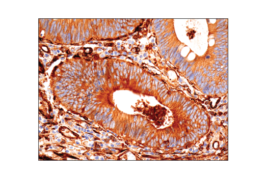 Immunohistochemistry Image 2: Vinculin (E1E9V) XP<sup>®</sup> Rabbit mAb (BSA and Azide Free)