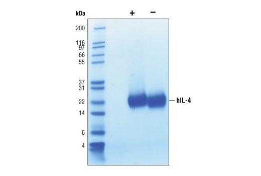 undefined Image 1: Human Interleukin-4 (hIL-4)