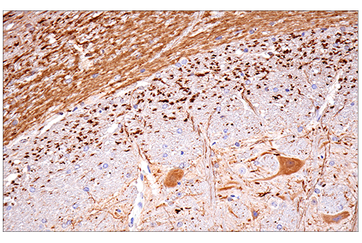 Immunohistochemistry Image 11: Calretinin (E7R6O) Rabbit Monoclonal Antibody