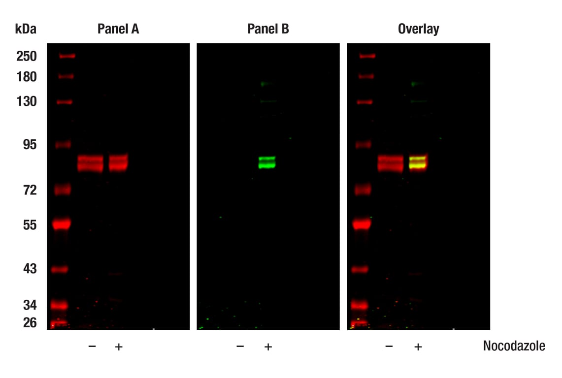 Phospho-DRP1 (Ser616) (D9A1) Rabbit Monoclonal Antibody | Cell Signaling  Technology