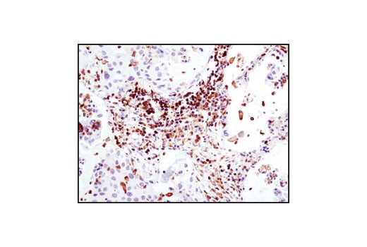 Immunohistochemistry Image 1: HS1 (D83A8) Rabbit Monoclonal Antibody
