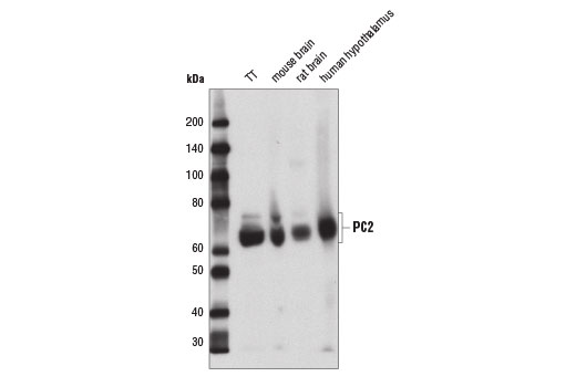 Western Blotting Image 2: PC2 (D1E1S) Rabbit Monoclonal Antibody