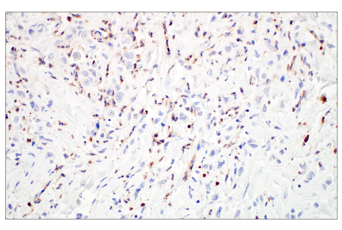 Immunohistochemistry Image 4: OLR1/LOX1 (E9C5A) Rabbit Monoclonal Antibody (BSA and Azide Free)