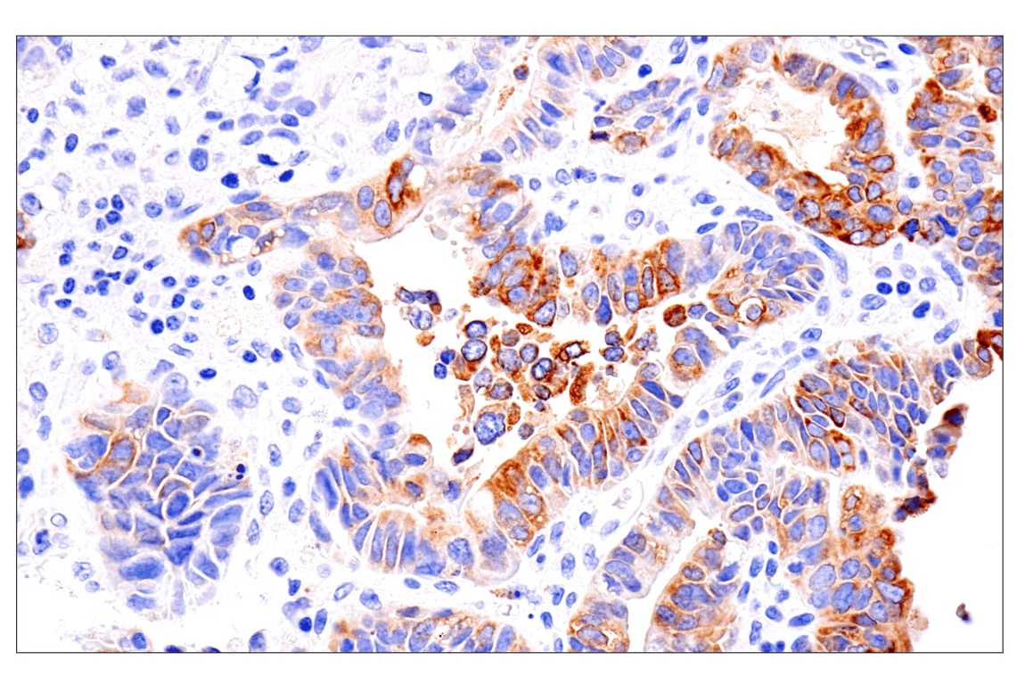 Immunohistochemistry Image 2: ENTPD5 (E5U3V) Rabbit Monoclonal Antibody