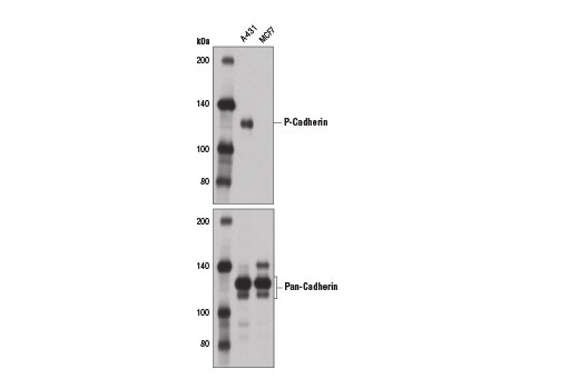 Western Blotting Image 1: P-Cadherin (12H6) Mouse mAb