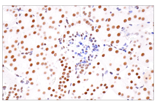 Immunohistochemistry Image 15: CPSF4 (E2L2Z) Rabbit Monoclonal Antibody