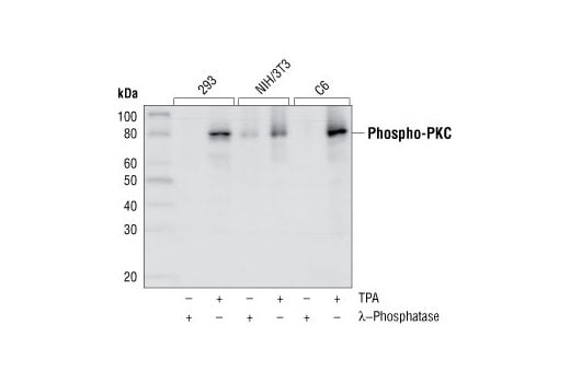 Western Blotting Image 2: Phospho-PKC (pan) (zeta Thr410) (190D10) Rabbit Monoclonal Antibody