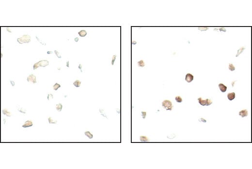 Immunohistochemistry Image 1: Phospho-eIF2 alpha (Ser51) (119A11) Rabbit Monoclonal Antibody
