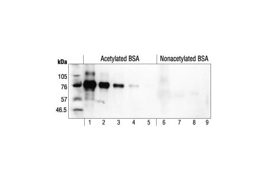 Western Blotting Image 2: Acetylated-Lysine Antibody