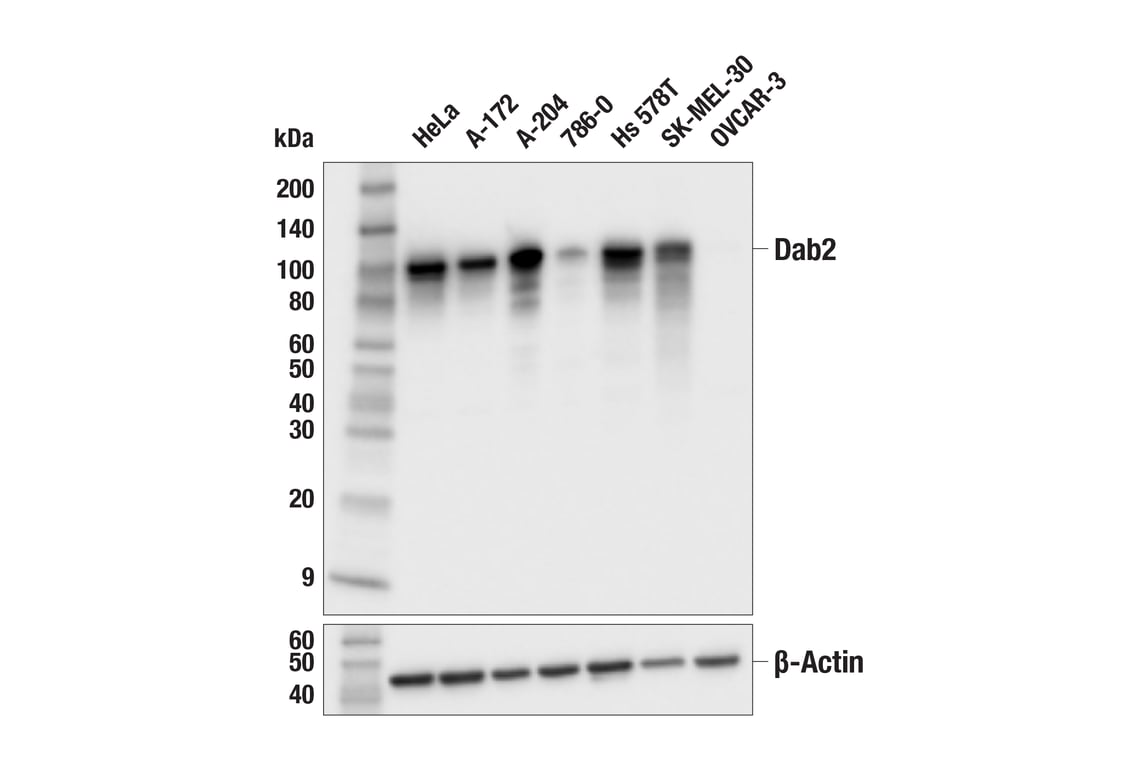 Western Blotting Image 1: Dab2 (F9K9T) Rabbit mAb