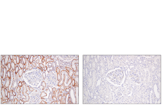 Immunohistochemistry Image 2: Semaphorin-4D/CD100 (E5C3B) Rabbit Monoclonal Antibody (BSA and Azide Free)