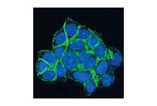 Immunofluorescence Image 1: gamma-Catenin Antibody
