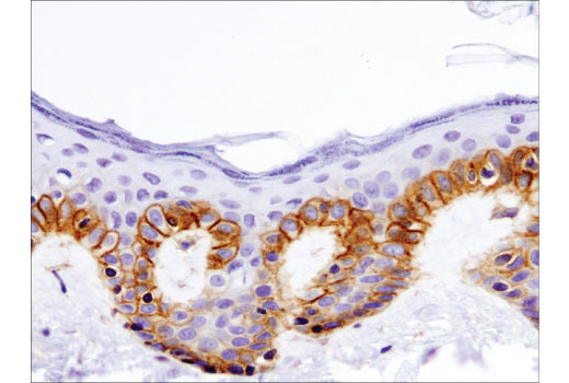 Immunohistochemistry Image 3: Integrin beta1 (D6S1W) Rabbit Monoclonal Antibody