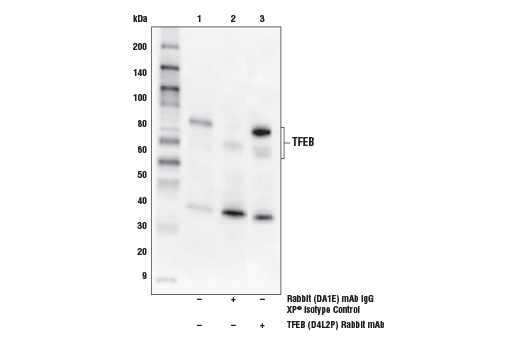 Immunoprecipitation Image 1: TFEB (D4L2P) Rabbit Monoclonal Antibody