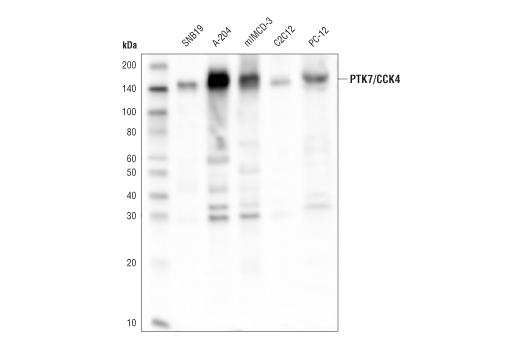 Western Blotting Image 1: PTK7/CCK4 (D2Z1N) Rabbit mAb