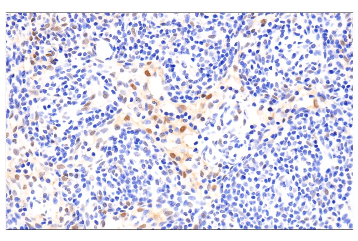 Immunohistochemistry Image 7: Phospho-Stat3 (Ser727) (D4X3C) Rabbit Monoclonal Antibody