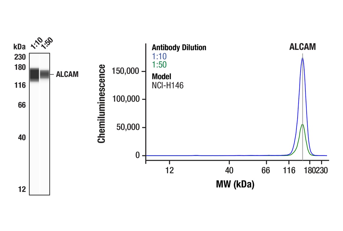 Western Blotting Image 1: ALCAM (F3V8Q) Rabbit Monoclonal Antibody