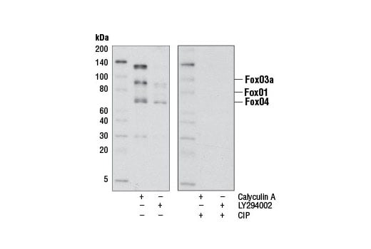 undefined Image 11: Forkhead Signaling Antibody Sampler Kit