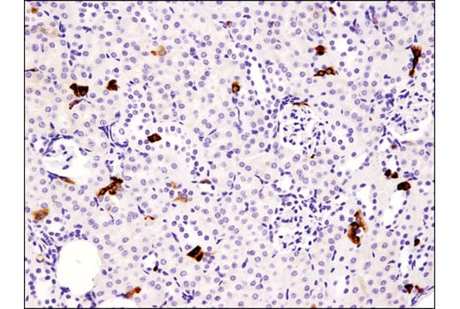 Immunohistochemistry Image 2: Stathmin (D1Y5A) Rabbit Monoclonal Antibody