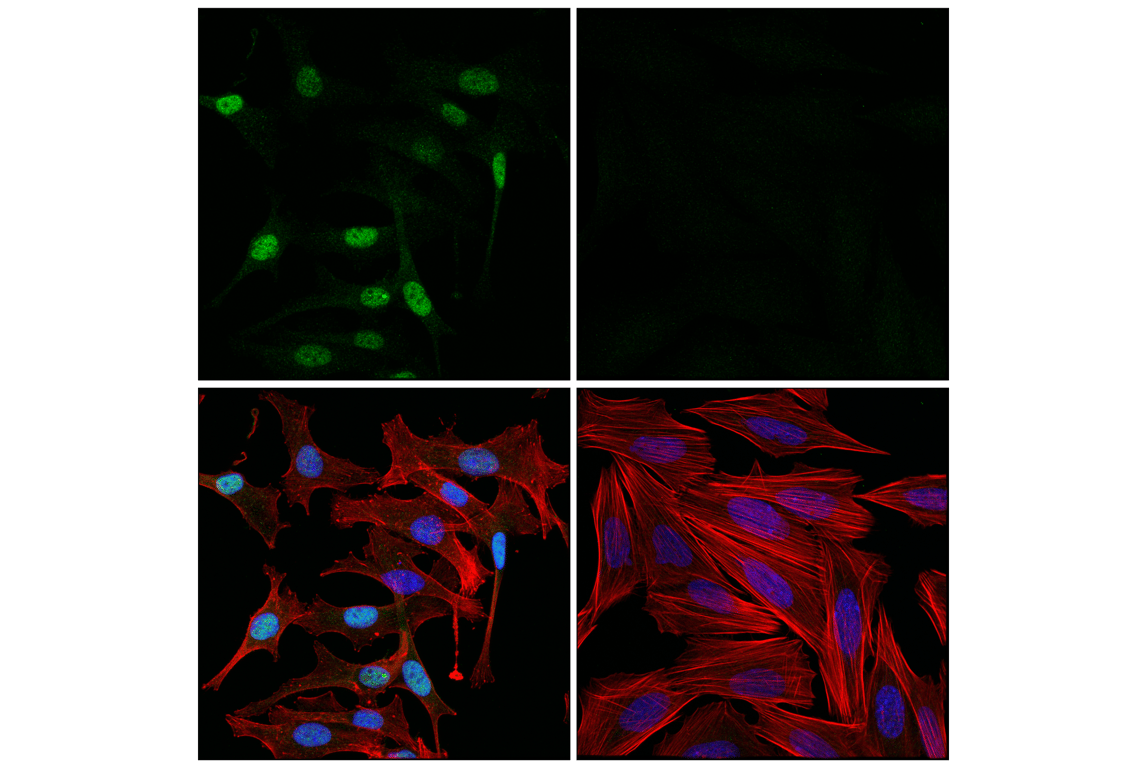 Immunofluorescence Image 1: ETV4 (E5Q1U) Rabbit Monoclonal Antibody