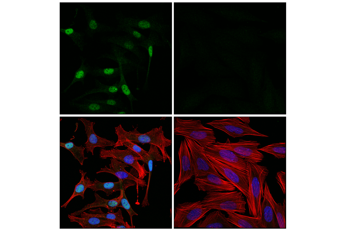 Immunofluorescence Image 1: ETV4 (E5Q1U) Rabbit mAb