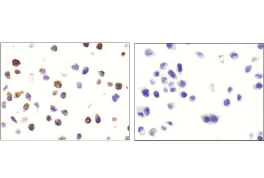 Immunohistochemistry Image 2: HGF beta (D6S7D) Rabbit Monoclonal Antibody