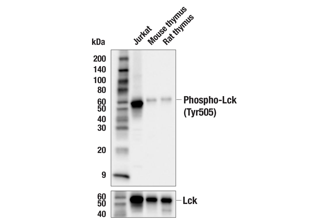 Western Blotting Image 3: Phospho-Lck (Tyr505) (E3Z5E) Rabbit Monoclonal Antibody