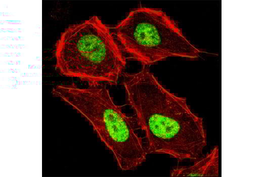 Immunofluorescence Image 1: MacroH2A1.2 Antibody