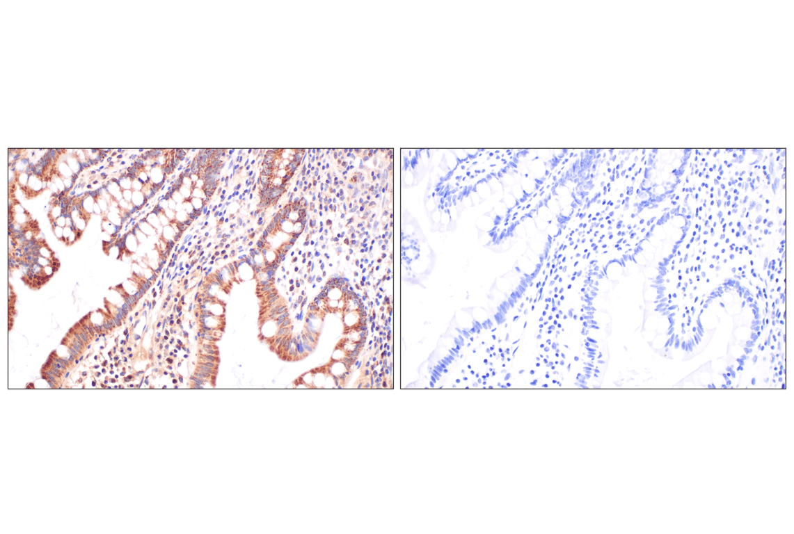 Immunohistochemistry Image 9: Fumarase (D9C5) Rabbit Monoclonal Antibody