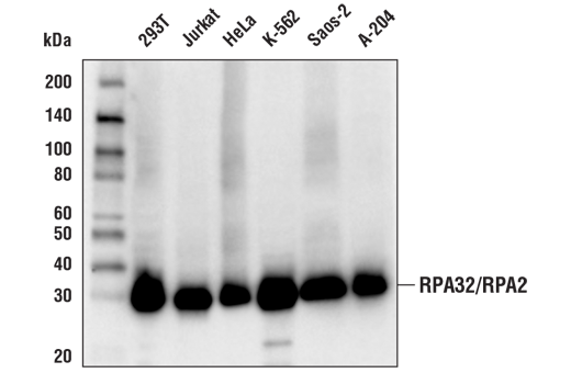 Western Blotting Image 1: RPA32/RPA2 (E8X5P) XP<sup>®</sup> Rabbit mAb