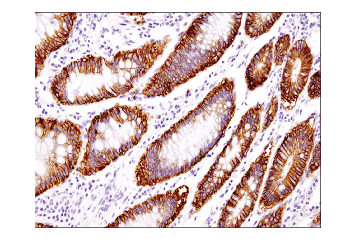 Immunohistochemistry Image 1: EpCAM (D9S3P) Rabbit Monoclonal Antibody (BSA and Azide Free)