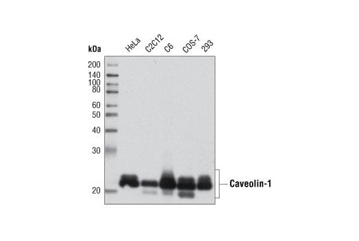 Western Blotting Image 1: Caveolin-1 Antibody