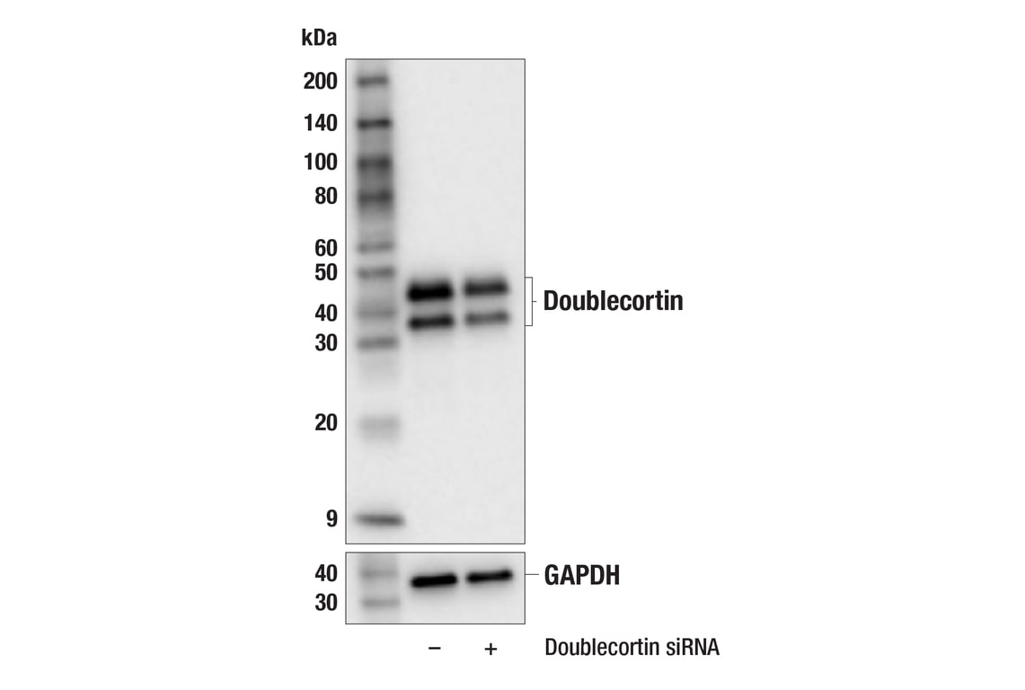 Western Blotting Image 2: Doublecortin (F6K9E) Rabbit Monoclonal Antibody